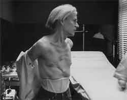 Andy Warhol à l'hôpital