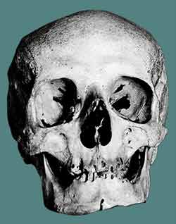 Crâne de Haydn
