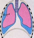 Pneumothorax et chant