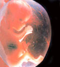 Bruit foetus